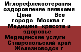 Иглорефлексотерапия, оздоровление пиявками › Цена ­ 3 000 - Все города, Москва г. Медицина, красота и здоровье » Медицинские услуги   . Ставропольский край,Железноводск г.